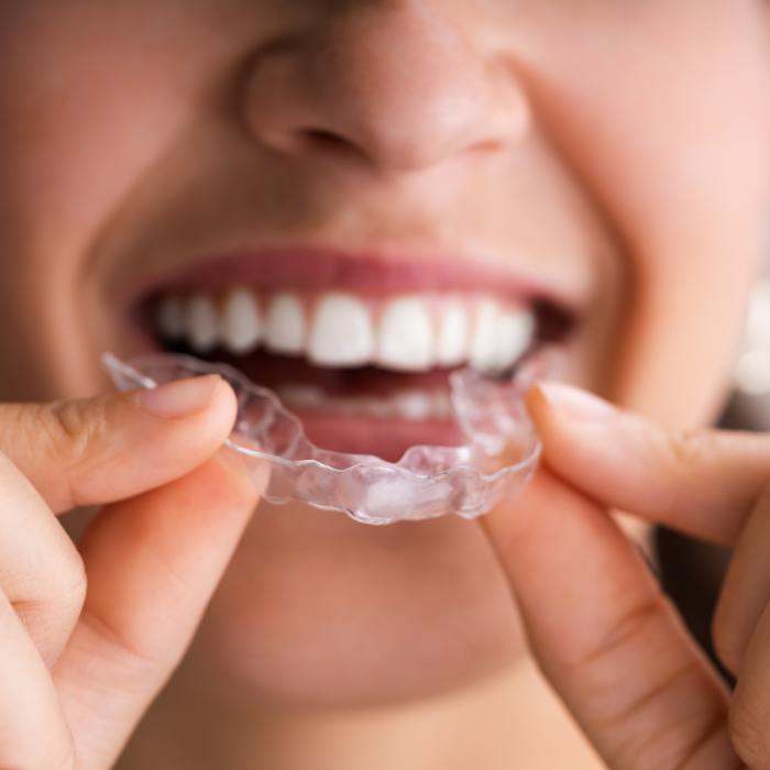 Clear aligners