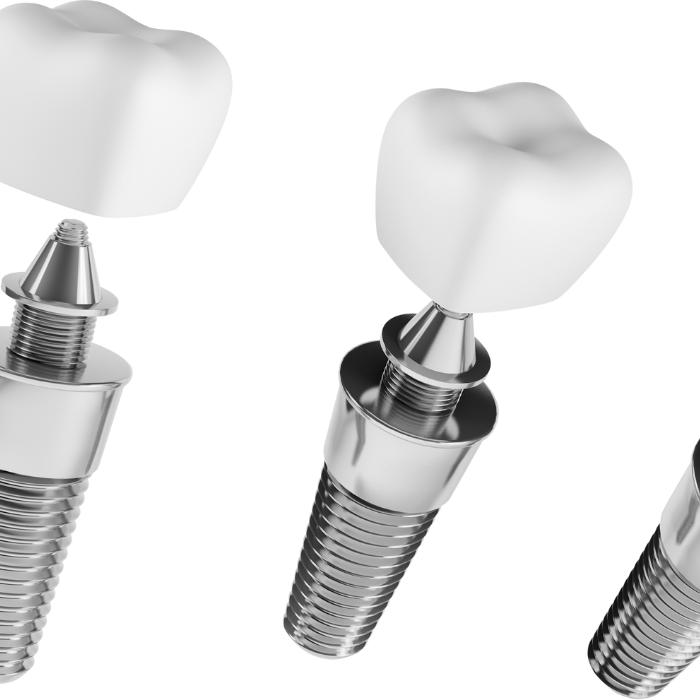 dental crowns