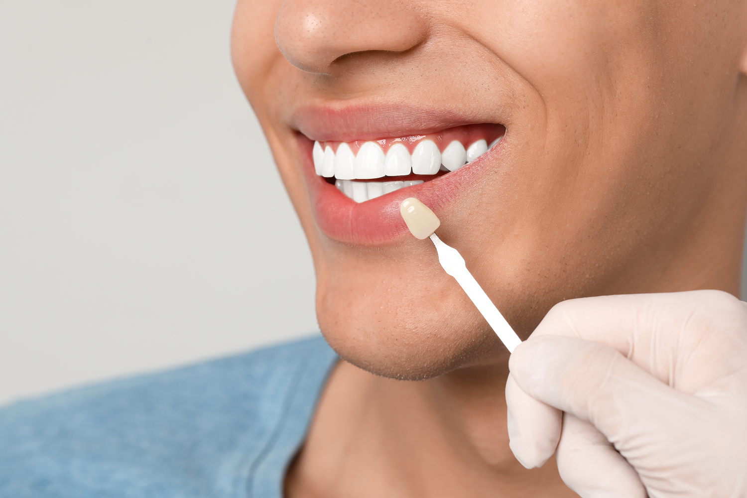 Close-up of a dental professional holding a single tooth shade sample against a patient's bright white smile during a cosmetic consultation